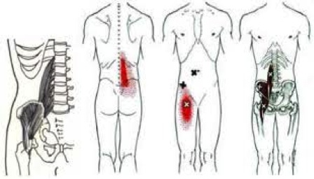 how long to release psoas